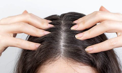 11 Simple Home Remedies To Get Rid Of Dandruff!
